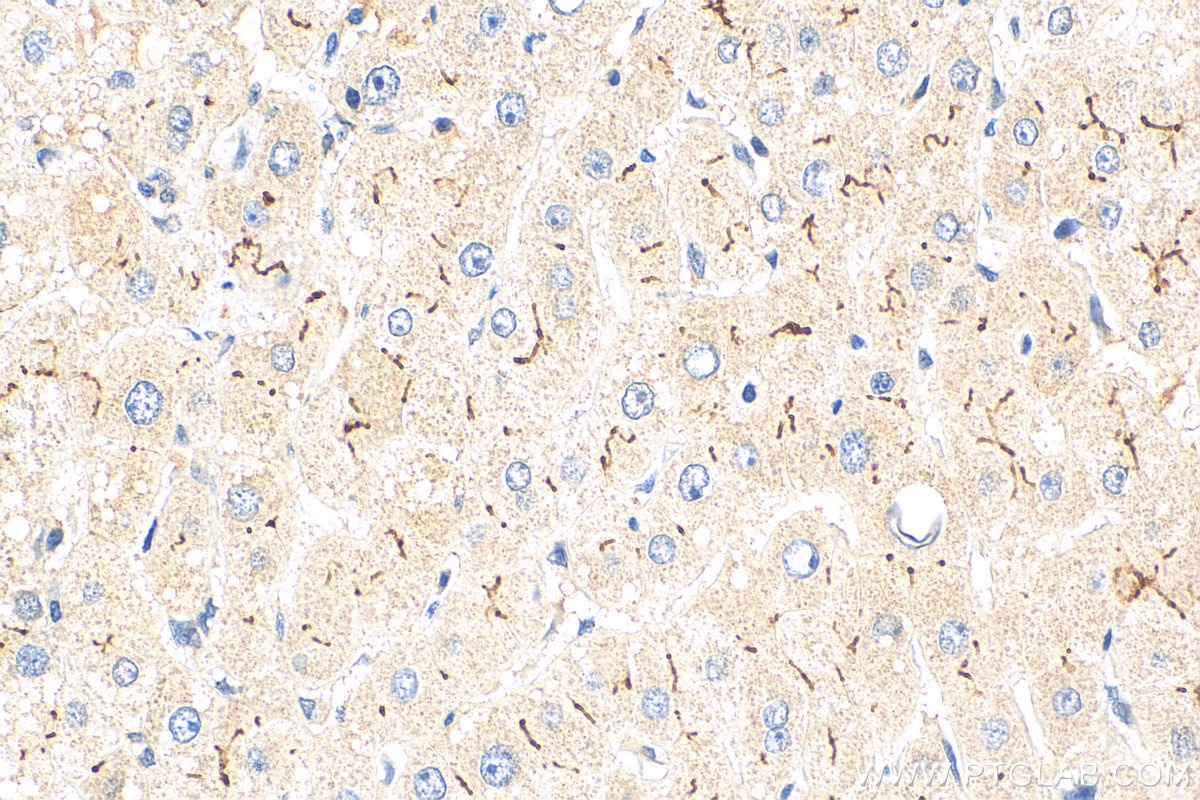 Immunohistochemistry (IHC) staining of human liver tissue using MRP2 Polyclonal antibody (29261-1-AP)
