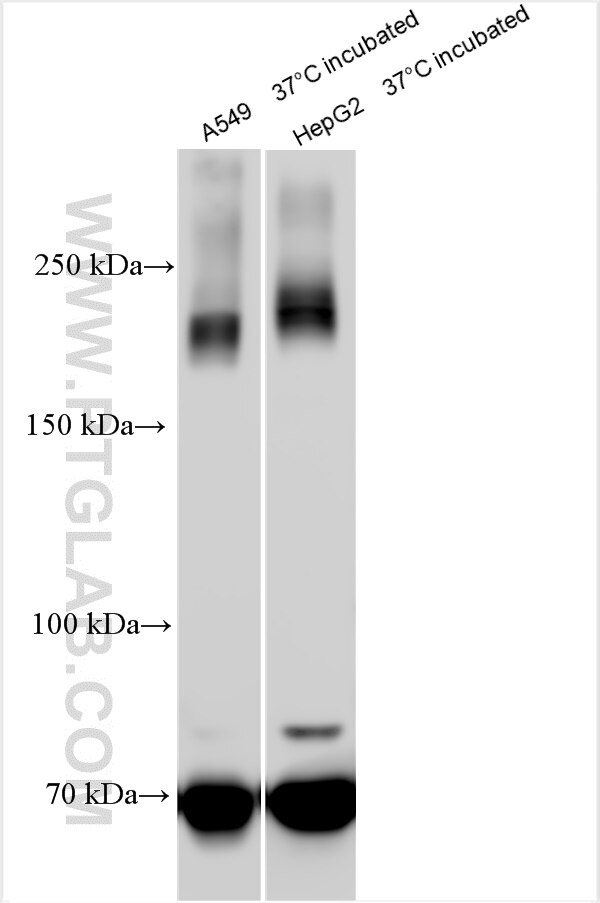 Western Blot (WB) analysis of various lysates using MRP2 Polyclonal antibody (29261-1-AP)
