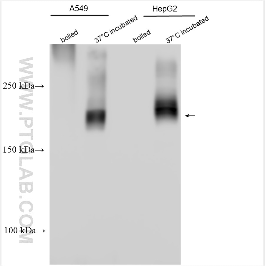 Western Blot (WB) analysis of various lysates using MRP2 Polyclonal antibody (29261-1-AP)
