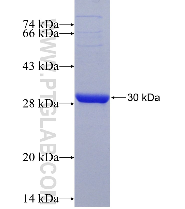 ABCC2 fusion protein Ag30944 SDS-PAGE