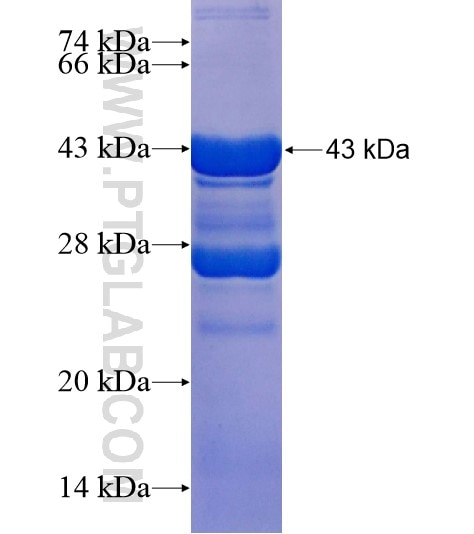ABCC2 fusion protein Ag18694 SDS-PAGE