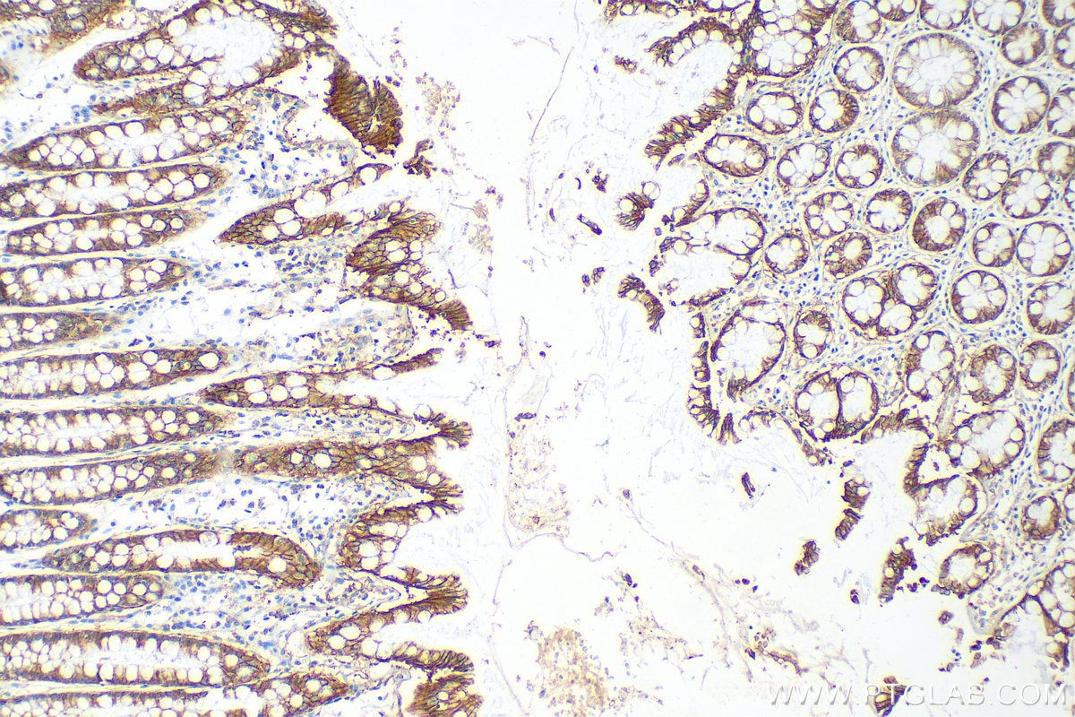 Immunohistochemistry (IHC) staining of human colon tissue using MRP3/ABCC3 Polyclonal antibody (25358-1-AP)