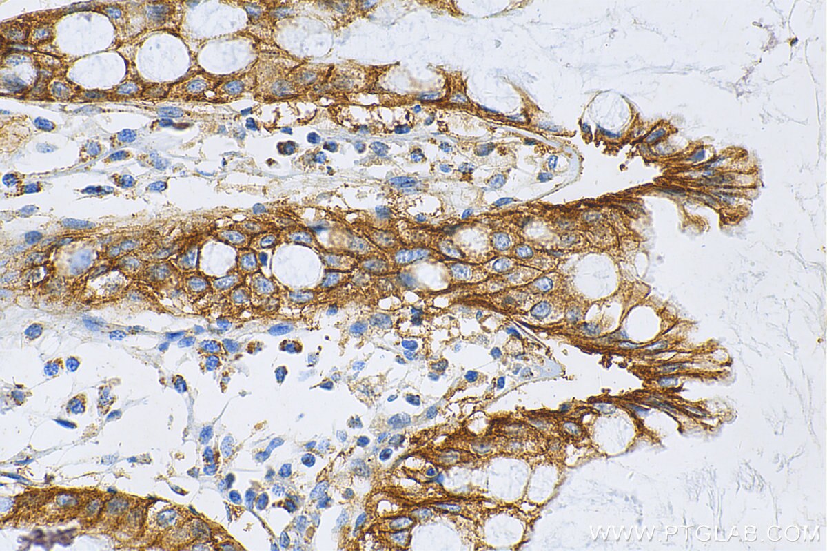 Immunohistochemistry (IHC) staining of human colon tissue using MRP3/ABCC3 Polyclonal antibody (25358-1-AP)