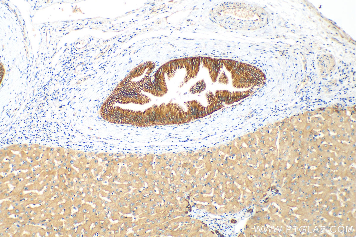 IHC staining of human liver using 25358-1-AP