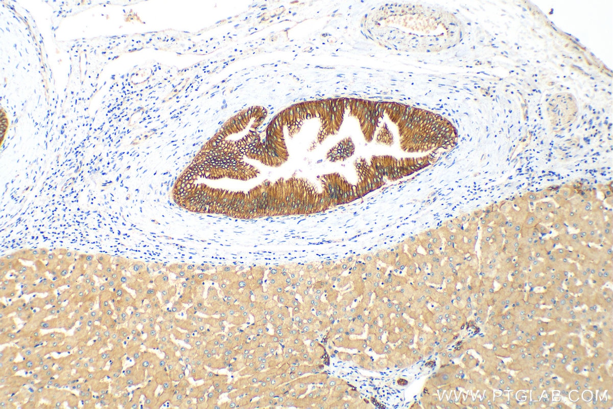 Immunohistochemistry (IHC) staining of human liver tissue using MRP3/ABCC3 Polyclonal antibody (25358-1-AP)