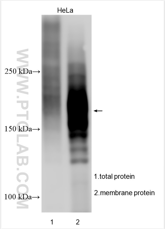 Western Blot (WB) analysis of various lysates using MRP3/ABCC3 Polyclonal antibody (25358-1-AP)