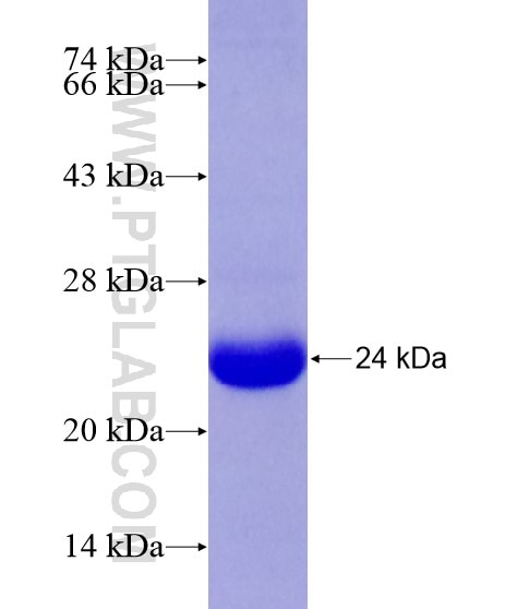 ABCC3 fusion protein Ag19801 SDS-PAGE