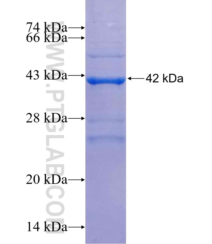 ABCC4 fusion protein Ag25937 SDS-PAGE