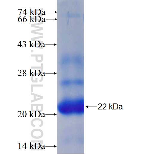 ABCC4 fusion protein Ag25963 SDS-PAGE