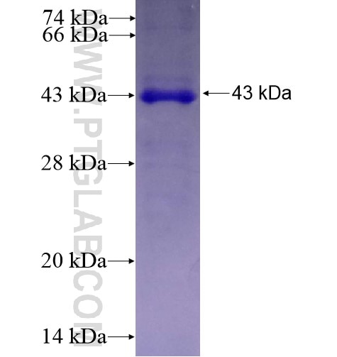 ABCC4 fusion protein Ag10171 SDS-PAGE