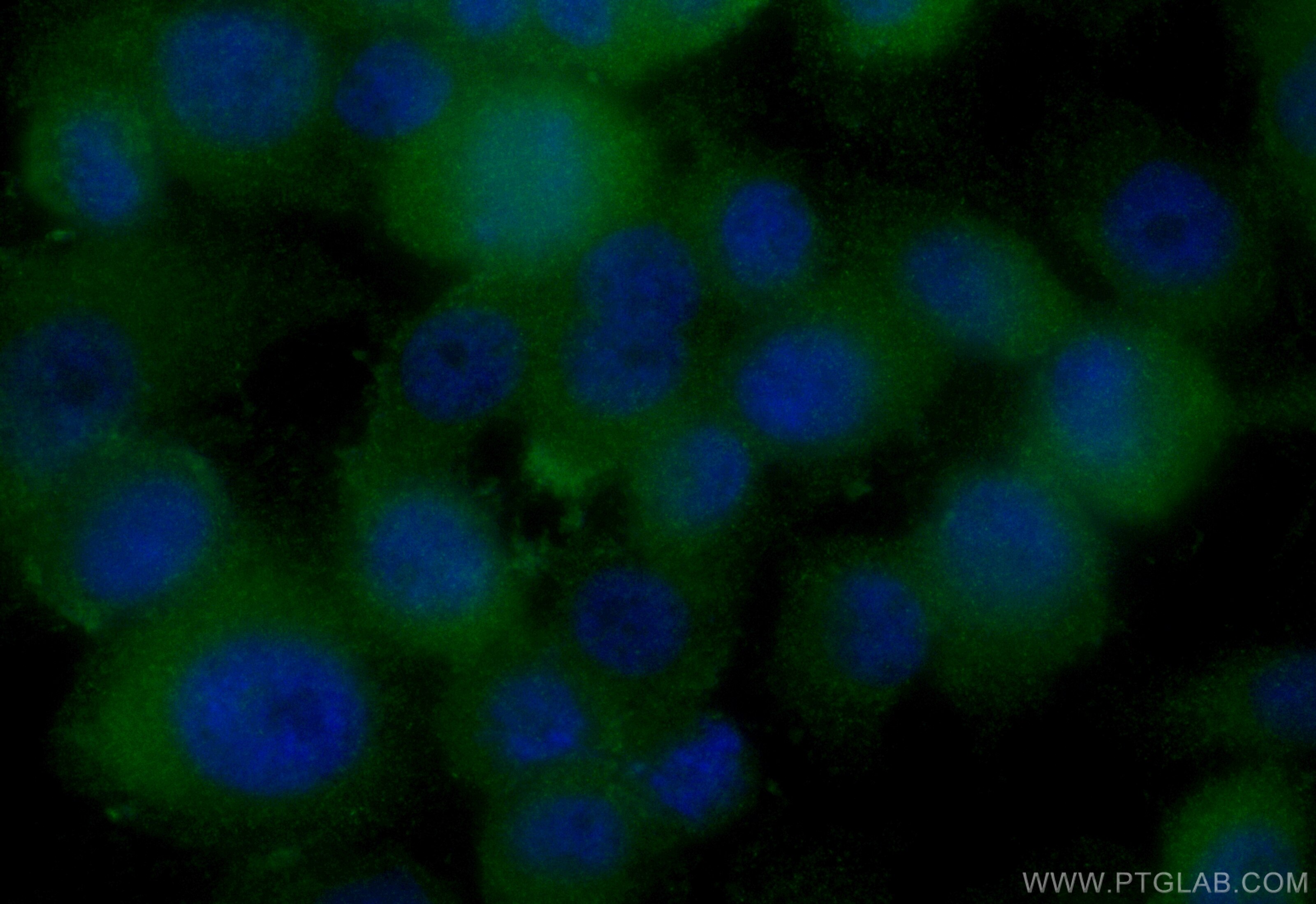 Immunofluorescence (IF) / fluorescent staining of PC-3 cells using CoraLite® Plus 488-conjugated ABCC5 Recombinant an (CL488-84204-5)