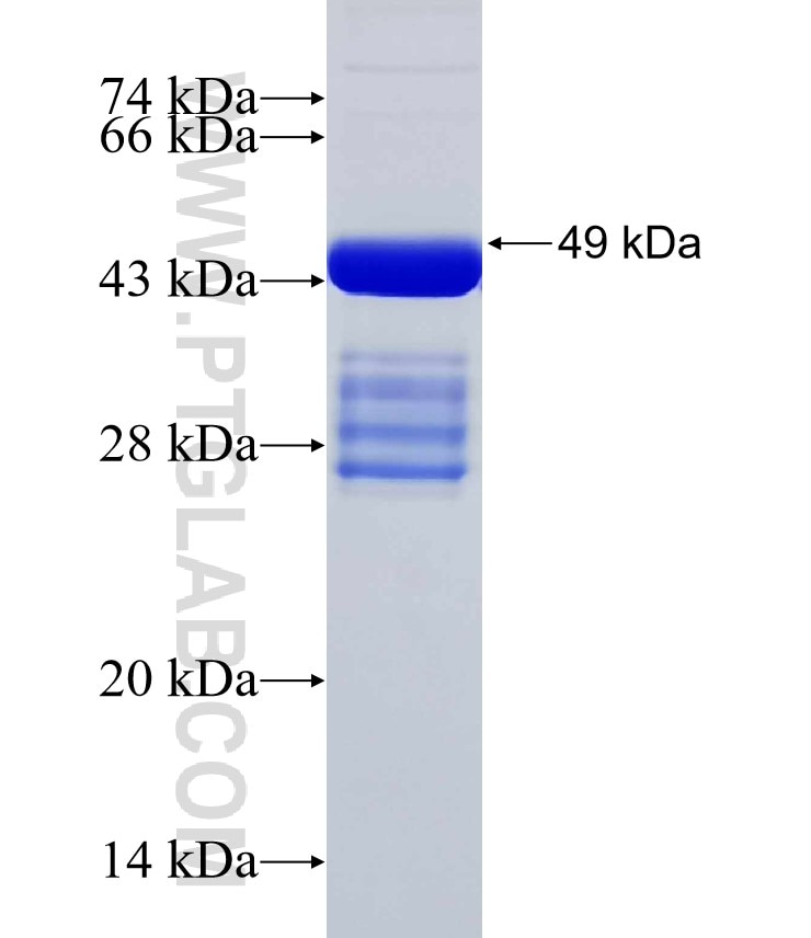 ABCC5 fusion protein Ag31680 SDS-PAGE
