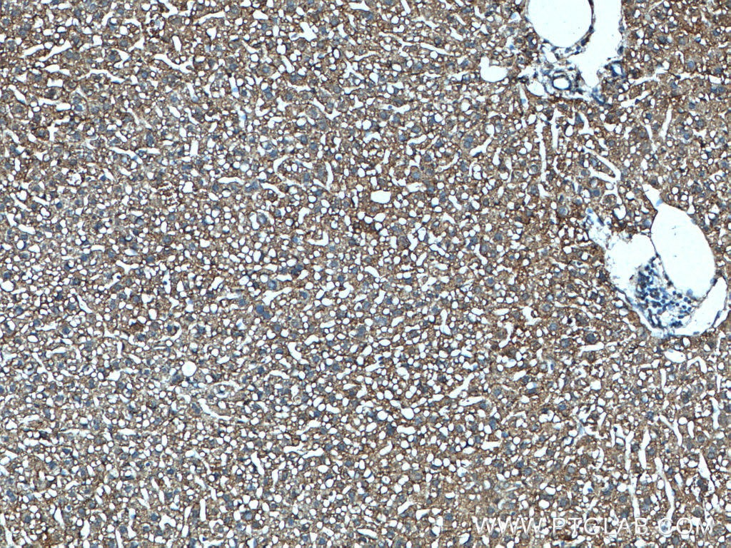 Immunohistochemistry (IHC) staining of mouse liver tissue using ABCC6 Polyclonal antibody (27848-1-AP)