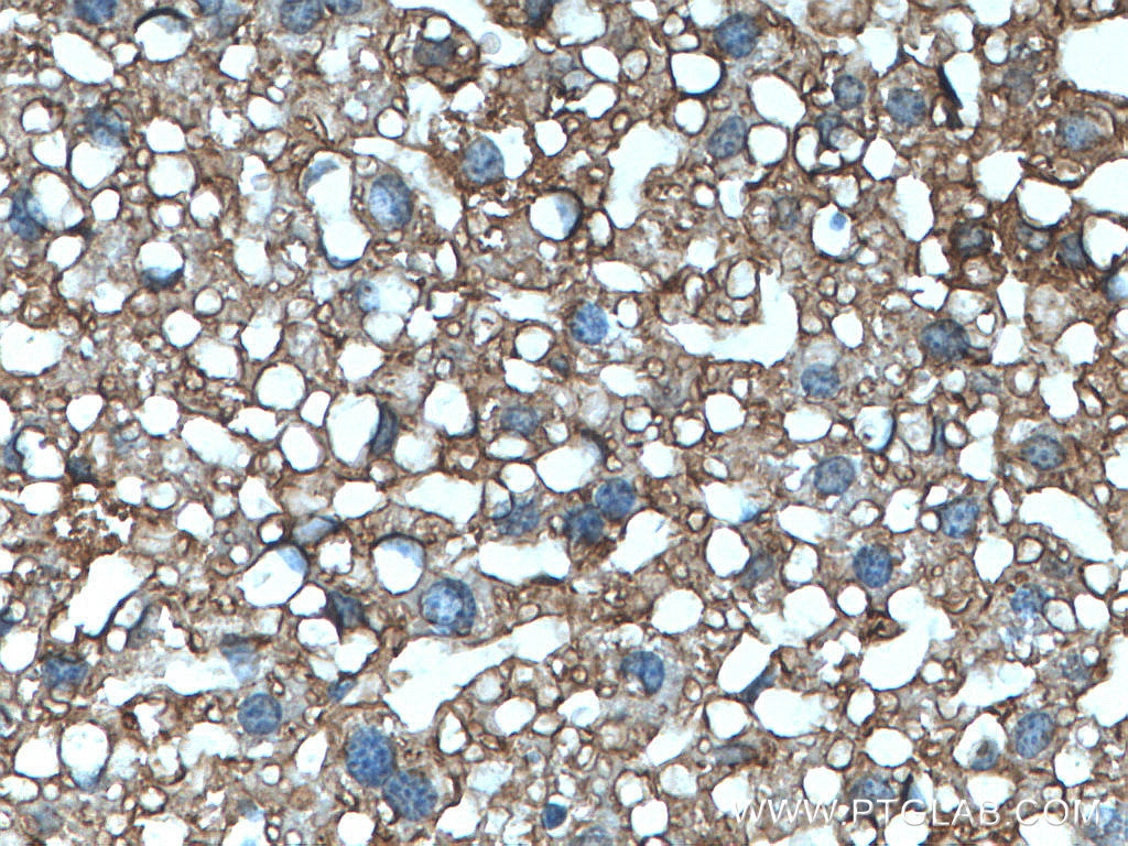Immunohistochemistry (IHC) staining of mouse liver tissue using ABCC6 Polyclonal antibody (27848-1-AP)