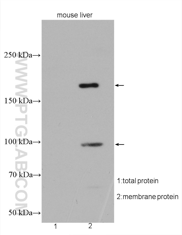 Western Blot (WB) analysis of mouse liver tissue using ABCC6 Polyclonal antibody (27848-1-AP)