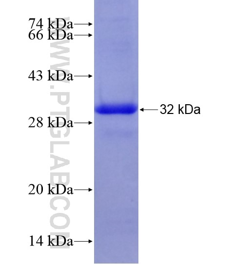 ABCC6 fusion protein Ag18640 SDS-PAGE