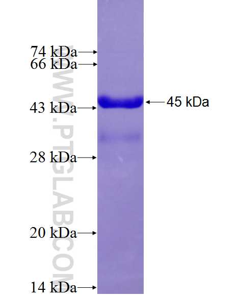 ABCC8 fusion protein Ag27186 SDS-PAGE