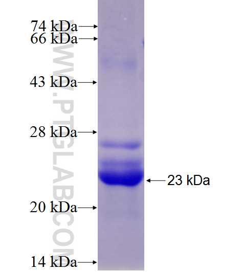 ABCC8 fusion protein Ag27197 SDS-PAGE