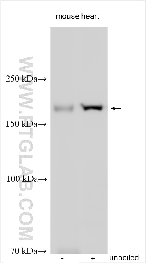 Western Blot (WB) analysis of various lysates using SUR2/ABCC9 Polyclonal antibody (13599-1-AP)