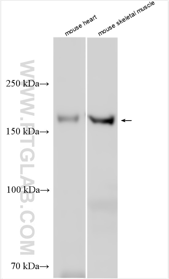 Western Blot (WB) analysis of various lysates using SUR2/ABCC9 Polyclonal antibody (13599-1-AP)