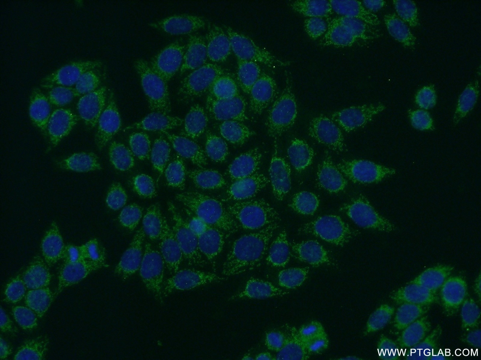 Immunofluorescence (IF) / fluorescent staining of HeLa cells using ABCD1 Polyclonal antibody (11159-1-AP)