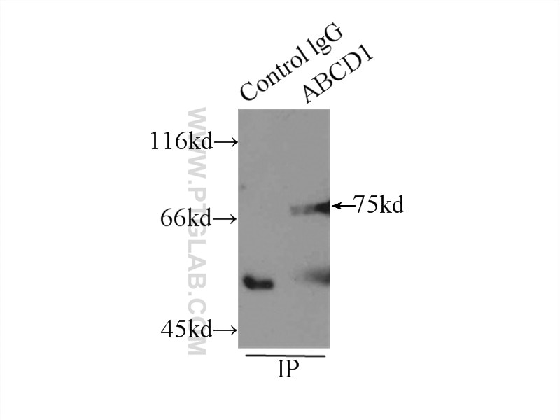 Immunoprecipitation (IP) experiment of mouse liver tissue using ABCD1 Polyclonal antibody (11159-1-AP)
