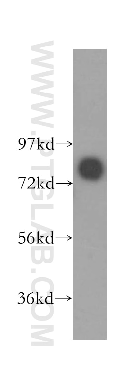 Western Blot (WB) analysis of human brain tissue using ABCD1 Polyclonal antibody (11159-1-AP)