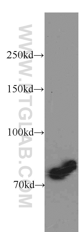 Western Blot (WB) analysis of mouse liver tissue using ABCD1 Polyclonal antibody (11159-1-AP)