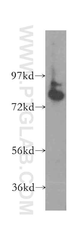 Western Blot (WB) analysis of HeLa cells using ABCD1 Polyclonal antibody (11159-1-AP)