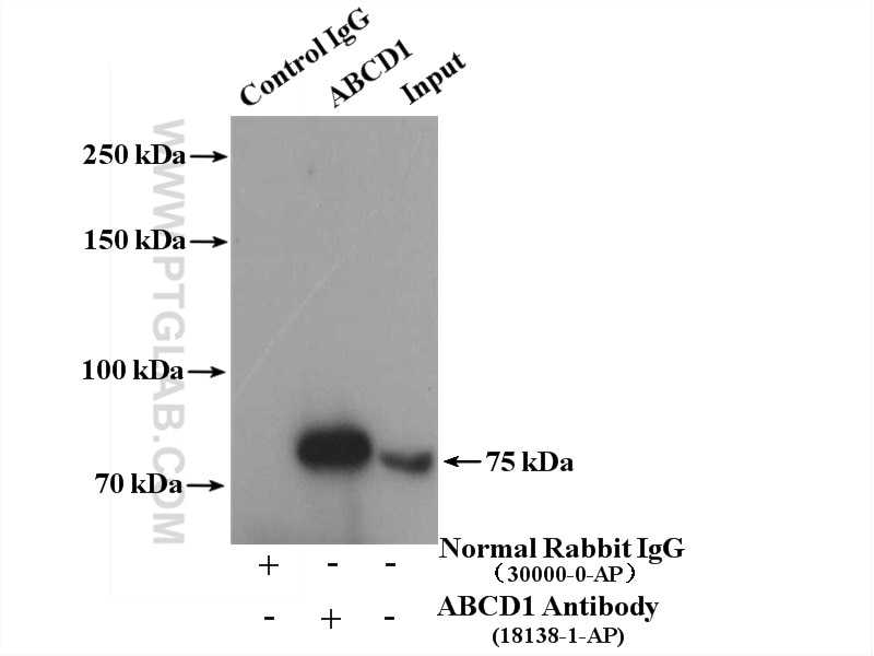 Immunoprecipitation (IP) experiment of HeLa cells using ABCD1 Polyclonal antibody (18138-1-AP)