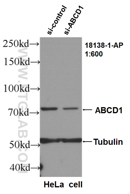 Western Blot (WB) analysis of HeLa cells using ABCD1 Polyclonal antibody (18138-1-AP)