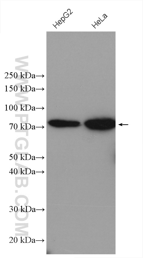 Western Blot (WB) analysis of various lysates using ABCD1 Polyclonal antibody (18138-1-AP)