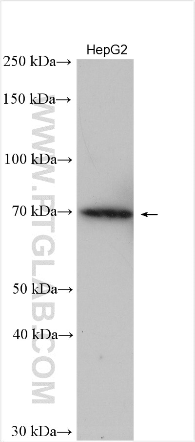 Western Blot (WB) analysis of HepG2 cells using ABCD1 Polyclonal antibody (18138-1-AP)