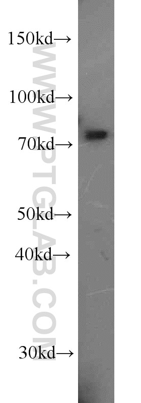 Western Blot (WB) analysis of HeLa cells using ABCD1 Polyclonal antibody (18138-1-AP)