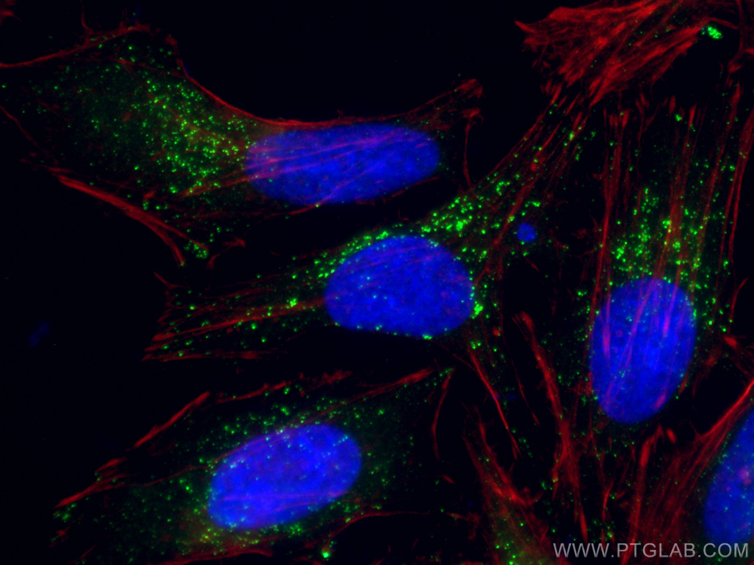Immunofluorescence (IF) / fluorescent staining of HeLa cells using ABCD1 Monoclonal antibody (60153-1-Ig)