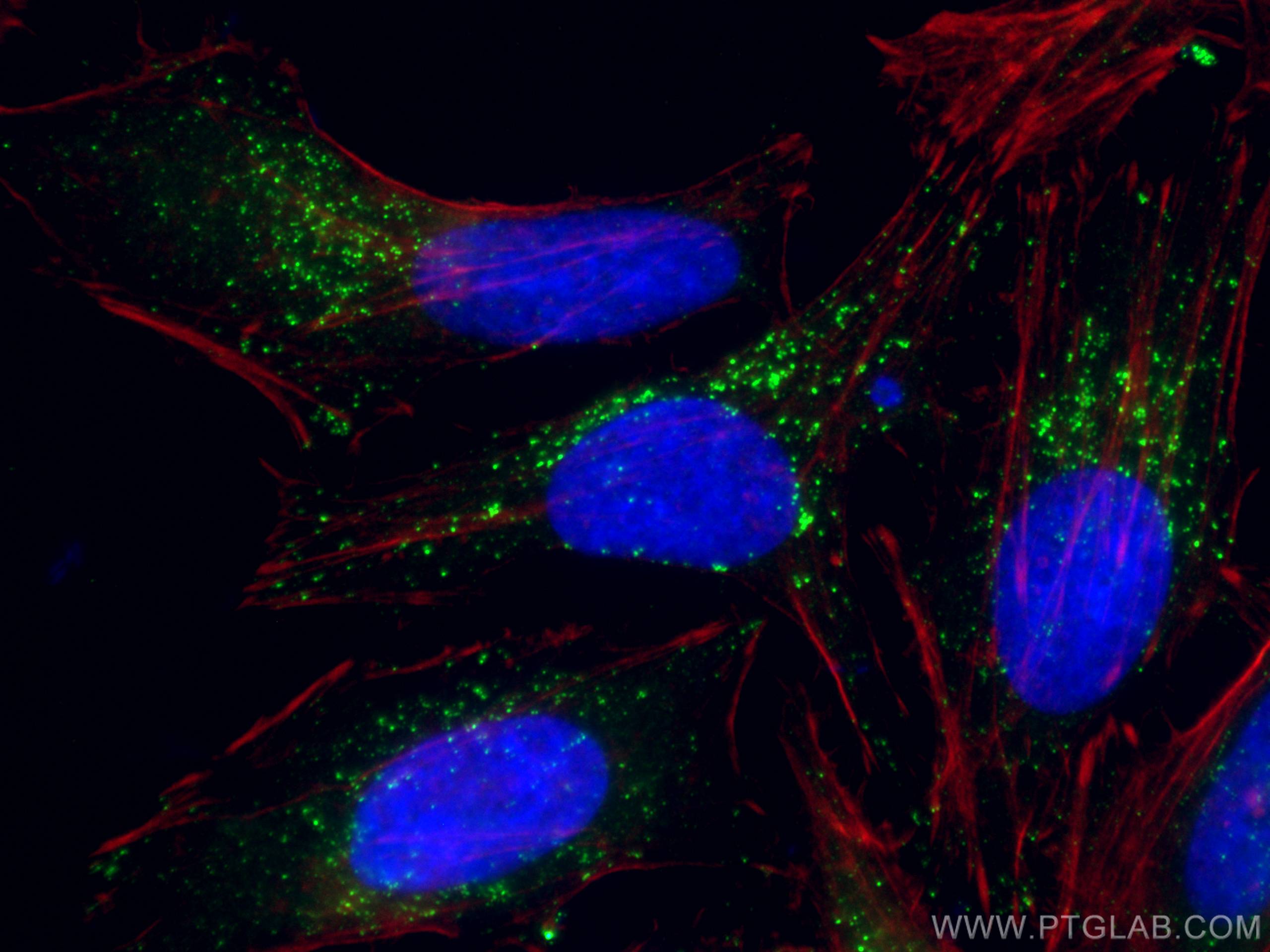 IF Staining of HeLa using 60153-1-Ig