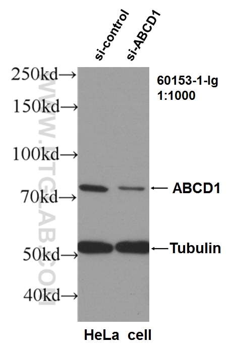 Western Blot (WB) analysis of HeLa cells using ABCD1 Monoclonal antibody (60153-1-Ig)