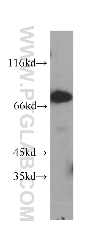 WB analysis of HeLa using 60153-1-Ig