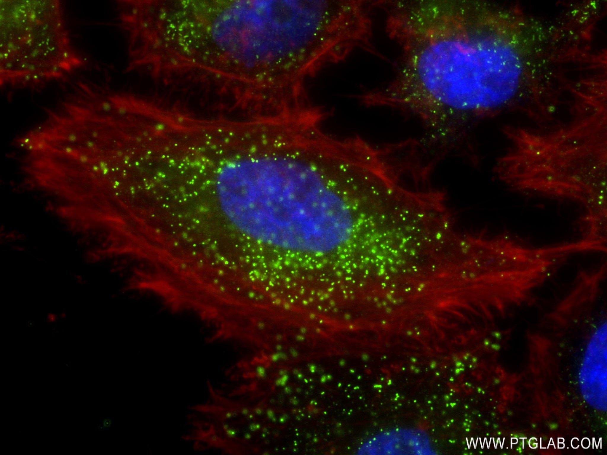 Immunofluorescence (IF) / fluorescent staining of HeLa cells using ABCD1 Recombinant antibody (83038-4-RR)