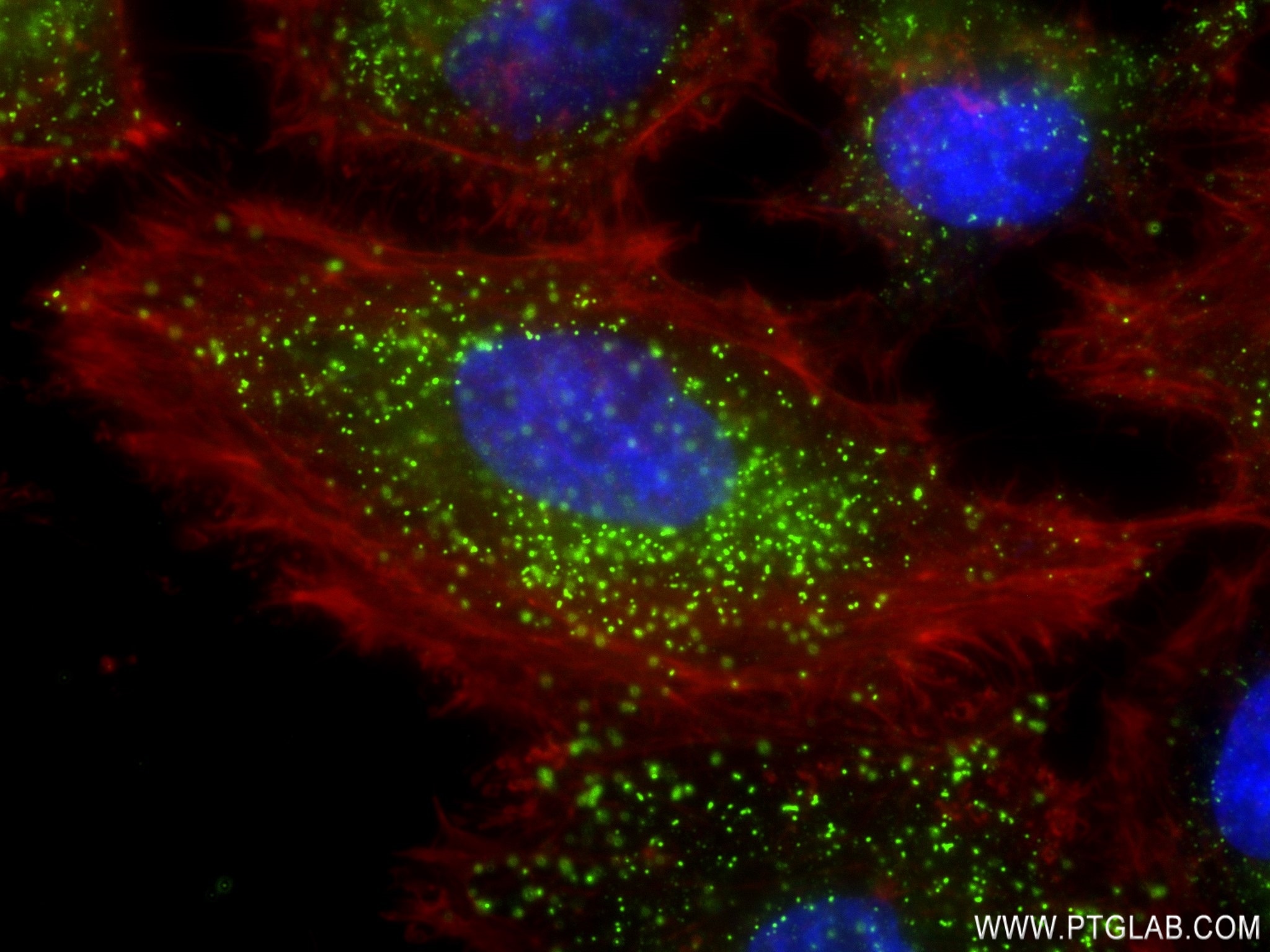 IF Staining of HeLa using 83038-4-RR