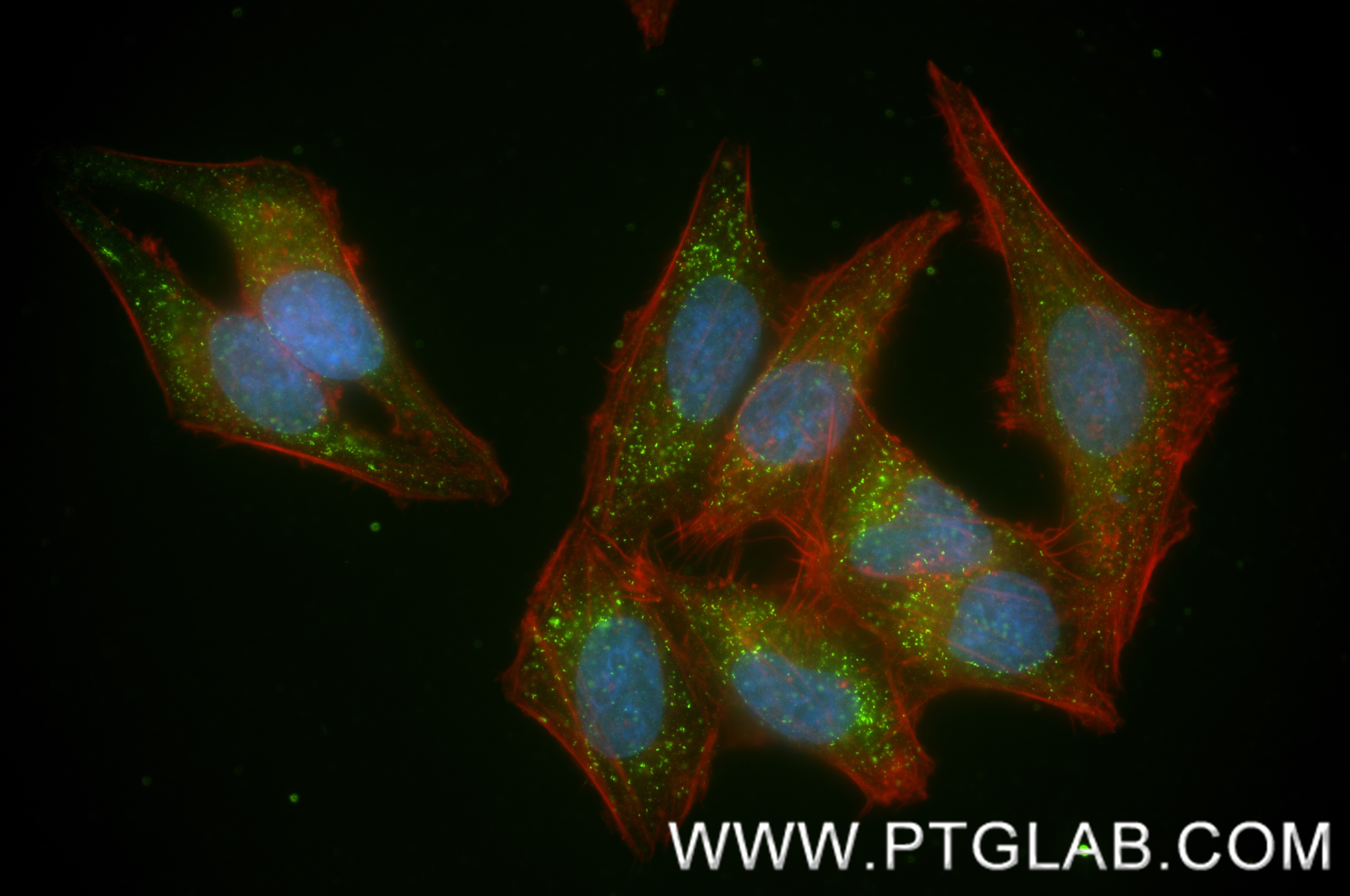 Immunofluorescent analysis of (4% PFA) fixed HepG2 cells using ABCD1 antibody (83038-4-RR, Clone: 230226E12 ) at dilution of 1:400 and CoraLite®488-Conjugated Goat Anti-Rabbit IgG(H+L) (SA00013-2), CL594-Phalloidin (red). This data was developed using the same antibody clone with 83038-4-PBS in a different storage buffer formulation. Immunofluorescence (IF) / fluorescent staining of HepG2 cells using ABCD1 Recombinant monoclonal antibody (83038-4-RR)