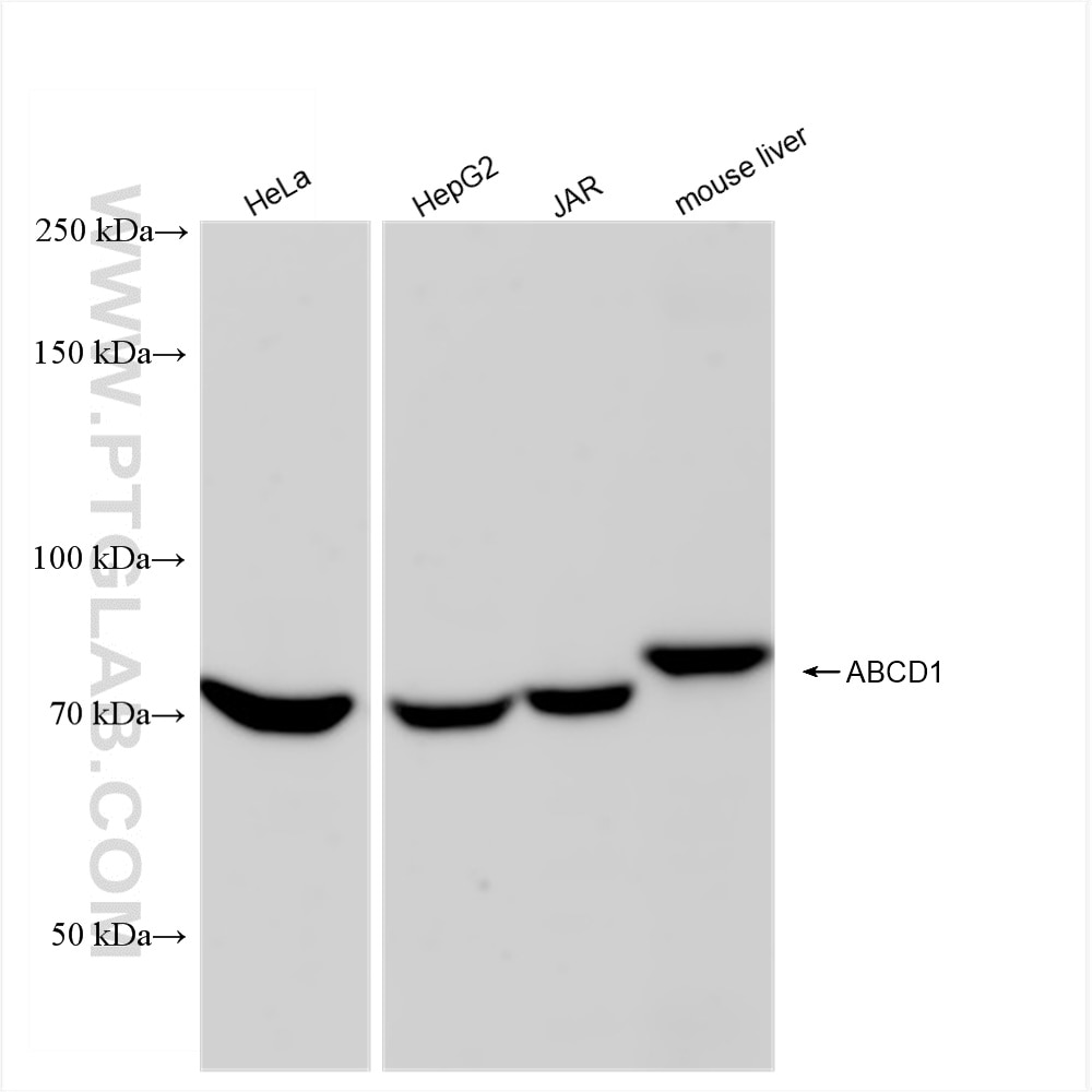 Western Blot (WB) analysis of various lysates using ABCD1 Recombinant antibody (83038-4-RR)