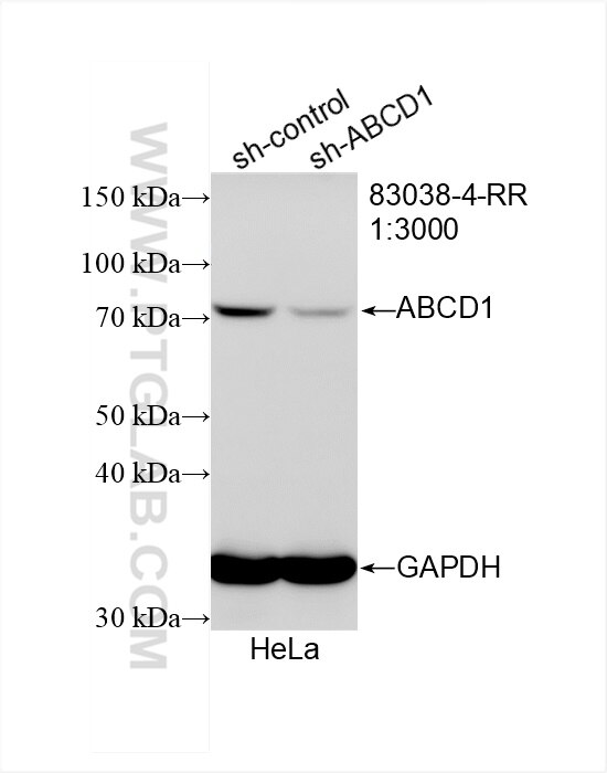 Western Blot (WB) analysis of HeLa cells using ABCD1 Recombinant antibody (83038-4-RR)