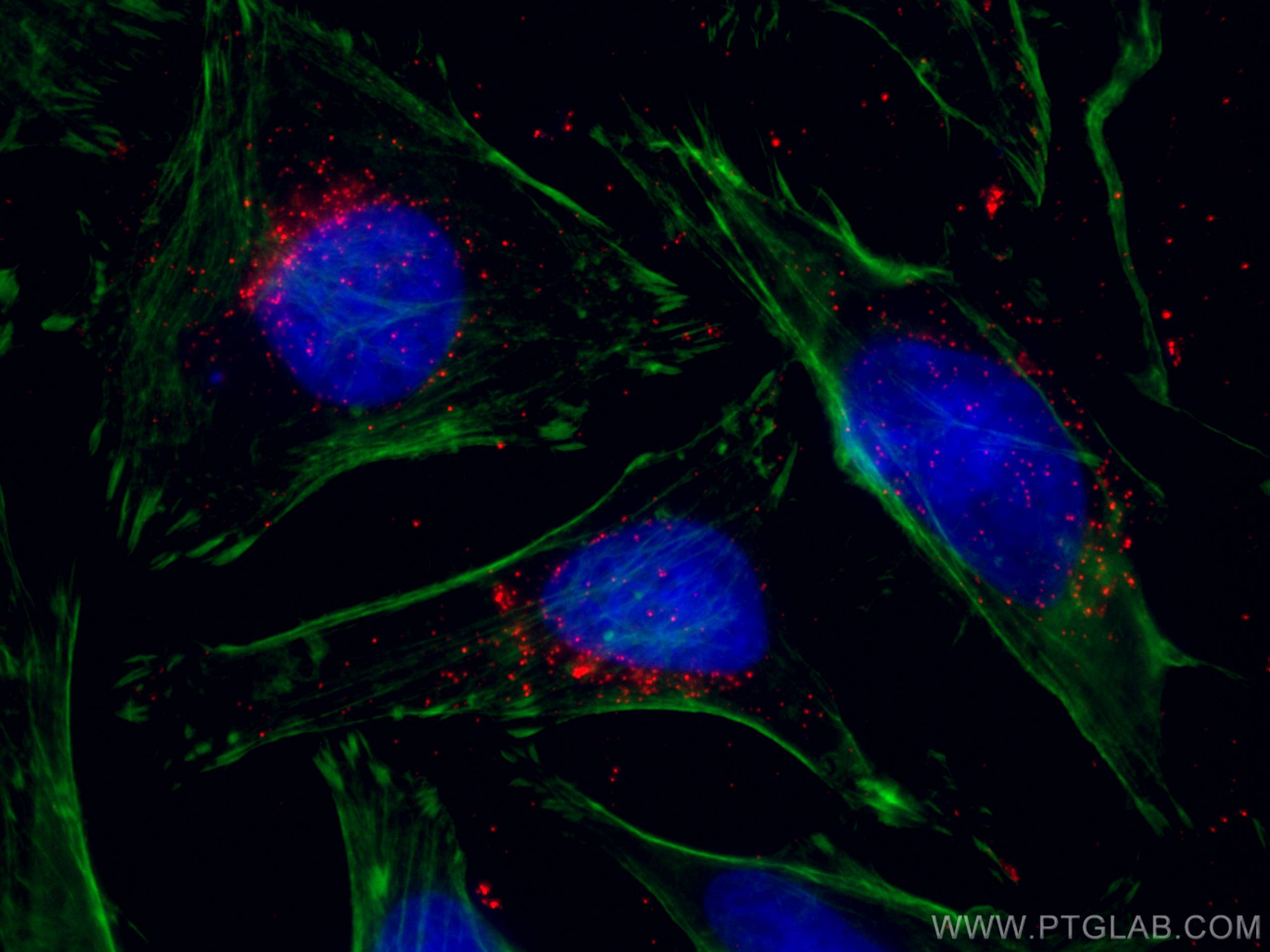 Immunofluorescence (IF) / fluorescent staining of HeLa cells using CoraLite®594-conjugated ABCD1 Monoclonal antibody (CL594-60153)