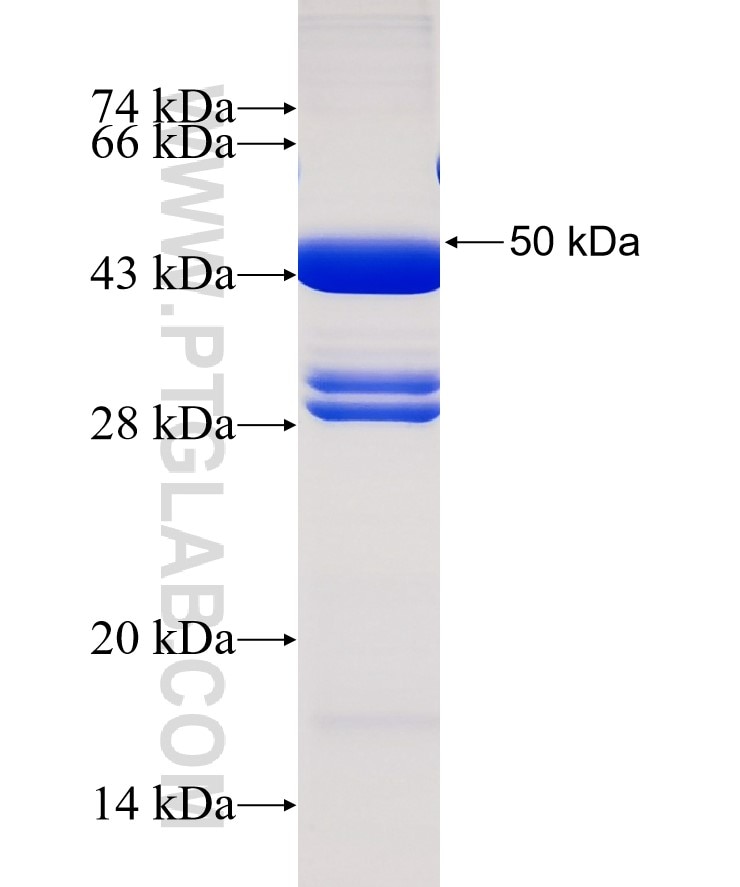 ABCD1 fusion protein Ag0453 SDS-PAGE