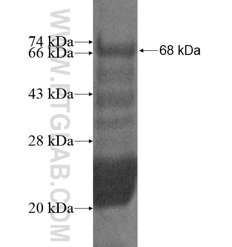 ABCD1 fusion protein Ag10962 SDS-PAGE