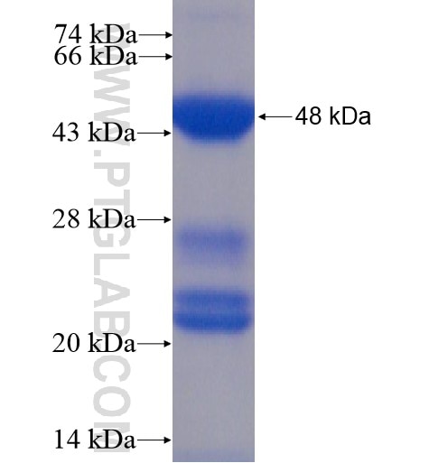 ABCD1 fusion protein Ag12757 SDS-PAGE