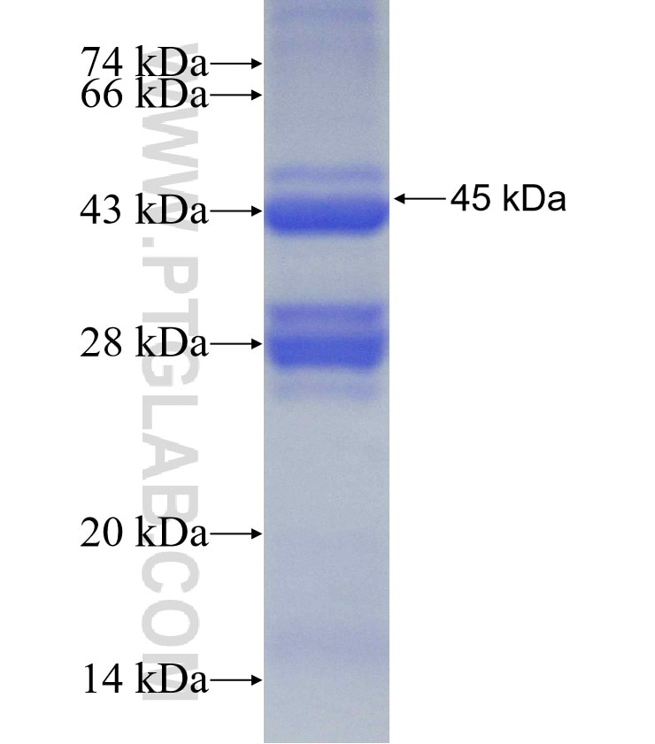 ABCD1 fusion protein Ag1635 SDS-PAGE