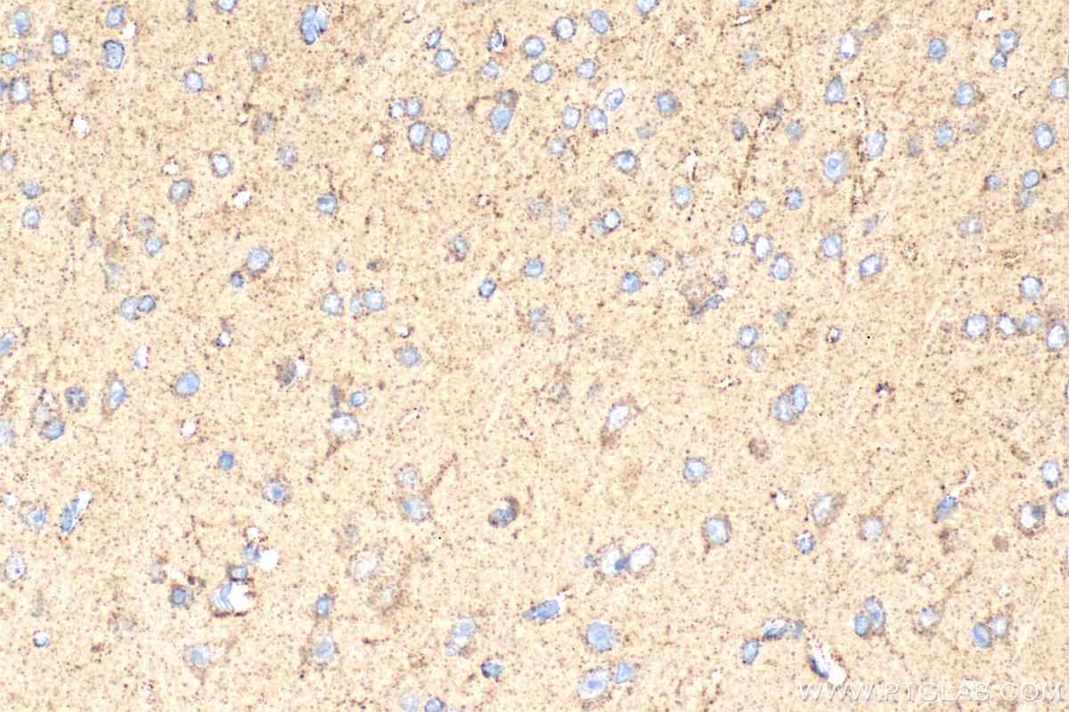 Immunohistochemistry (IHC) staining of mouse brain tissue using ABCD2 Polyclonal antibody (18179-1-AP)