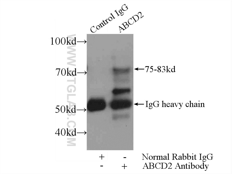 Immunoprecipitation (IP) experiment of A431 cells using ABCD2 Polyclonal antibody (18179-1-AP)